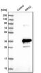Proteoglycan 2, Pro Eosinophil Major Basic Protein antibody, NBP1-88573, Novus Biologicals, Western Blot image 
