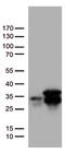 O-6-Methylguanine-DNA Methyltransferase antibody, LS-C796817, Lifespan Biosciences, Western Blot image 