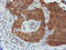 TUB Like Protein 3 antibody, LS-C173666, Lifespan Biosciences, Immunohistochemistry paraffin image 