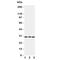 TNF Receptor Superfamily Member 4 antibody, R31253, NSJ Bioreagents, Western Blot image 