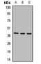 Methylenetetrahydrofolate Dehydrogenase (NADP+ Dependent) 2, Methenyltetrahydrofolate Cyclohydrolase antibody, LS-C667923, Lifespan Biosciences, Western Blot image 