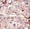 Aurora Kinase B antibody, LS-C100777, Lifespan Biosciences, Immunohistochemistry frozen image 