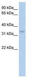 Carbonic Anhydrase 4 antibody, TA346047, Origene, Western Blot image 