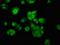 MET Transcriptional Regulator MACC1 antibody, orb415949, Biorbyt, Immunocytochemistry image 