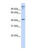 AFG3 Like Matrix AAA Peptidase Subunit 2 antibody, NBP1-59572, Novus Biologicals, Western Blot image 