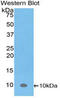 CAMP-Dependent Protein Kinase Inhibitor Alpha antibody, LS-C296116, Lifespan Biosciences, Western Blot image 