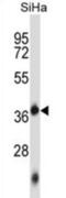 Deoxynucleotidyltransferase terminal-interacting protein 1 antibody, abx027276, Abbexa, Western Blot image 