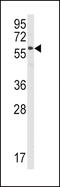 Signal Transducing Adaptor Molecule antibody, MBS9209273, MyBioSource, Western Blot image 