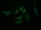 Gamma-Butyrobetaine Hydroxylase 1 antibody, M09779, Boster Biological Technology, Immunofluorescence image 