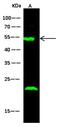 Transforming Growth Factor Beta Receptor 1 antibody, GTX02321, GeneTex, Western Blot image 