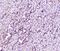 Large Tumor Suppressor Kinase 1 antibody, A01051-2, Boster Biological Technology, Immunohistochemistry paraffin image 