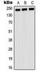 Myosin Heavy Chain 9 antibody, LS-C353759, Lifespan Biosciences, Western Blot image 