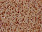 Histone Cluster 1 H1 Family Member C antibody, LS-C676863, Lifespan Biosciences, Immunohistochemistry paraffin image 