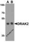 Serine/Threonine Kinase 17b antibody, 2149, ProSci, Western Blot image 