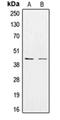 Fucosyltransferase 9 antibody, orb340873, Biorbyt, Western Blot image 