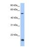 CKLF Like MARVEL Transmembrane Domain Containing 8 antibody, NBP1-59463, Novus Biologicals, Western Blot image 