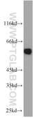 Polypyrimidine Tract Binding Protein 1 antibody, 55181-1-AP, Proteintech Group, Western Blot image 