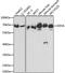 Succinate Dehydrogenase Complex Flavoprotein Subunit A antibody, A2594, ABclonal Technology, Western Blot image 