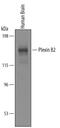 Plexin B2 antibody, PA5-47721, Invitrogen Antibodies, Western Blot image 