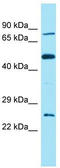 Family With Sequence Similarity 111 Member B antibody, TA335894, Origene, Western Blot image 