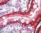 DIOII antibody, NBP1-00178, Novus Biologicals, Immunohistochemistry paraffin image 
