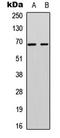 A-Raf Proto-Oncogene, Serine/Threonine Kinase antibody, LS-C358904, Lifespan Biosciences, Western Blot image 