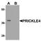 Prickle Planar Cell Polarity Protein 4 antibody, A14637, Boster Biological Technology, Western Blot image 