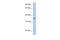 Proline Rich 18 antibody, A18667, Boster Biological Technology, Western Blot image 