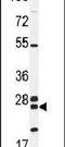 Nudix Hydrolase 8 antibody, PA5-24060, Invitrogen Antibodies, Western Blot image 