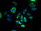 Transmembrane Protein 143 antibody, A63588-100, Epigentek, Immunofluorescence image 