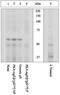 Protein Kinase CAMP-Dependent Type II Regulatory Subunit Beta antibody, GTX60925, GeneTex, Western Blot image 