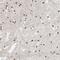 AF4/FMR2 Family Member 4 antibody, HPA023690, Atlas Antibodies, Immunohistochemistry paraffin image 