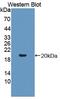 Amyloid Beta Precursor Like Protein 1 antibody, abx128264, Abbexa, Western Blot image 