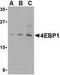 Eukaryotic Translation Initiation Factor 4E Binding Protein 1 antibody, TA306222, Origene, Western Blot image 