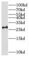 THAP Domain Containing 2 antibody, FNab08661, FineTest, Western Blot image 