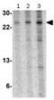Thymic Stromal Lymphopoietin antibody, ab115700, Abcam, Western Blot image 