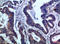 Interleukin 17F antibody, STJ99010, St John