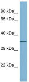 HCV NS5A-transactivated protein 7 antibody, TA345090, Origene, Western Blot image 