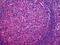 CD48 Molecule antibody, 51-681, ProSci, Immunohistochemistry paraffin image 