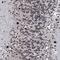 RUN And FYVE Domain Containing 2 antibody, HPA039792, Atlas Antibodies, Immunohistochemistry paraffin image 