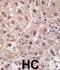 Proteasome Subunit Alpha 5 antibody, abx028095, Abbexa, Immunohistochemistry paraffin image 