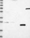 Kelch Like Family Member 41 antibody, NBP1-80788, Novus Biologicals, Western Blot image 