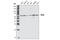 DEAD-Box Helicase 5 antibody, 4387S, Cell Signaling Technology, Western Blot image 