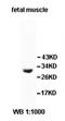 Hydroxysteroid 17-Beta Dehydrogenase 12 antibody, orb77895, Biorbyt, Western Blot image 