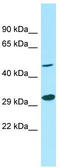 G Protein Subunit Alpha 13 antibody, TA331256, Origene, Western Blot image 