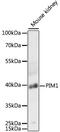 Pim-1 Proto-Oncogene, Serine/Threonine Kinase antibody, 15-430, ProSci, Western Blot image 