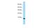 Putative uncharacterized protein C17orf91 antibody, PA5-70876, Invitrogen Antibodies, Western Blot image 