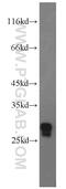 Glutathione S-Transferase Zeta 1 antibody, 14889-1-AP, Proteintech Group, Western Blot image 