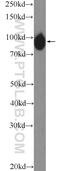 Hexose-6-Phosphate Dehydrogenase/Glucose 1-Dehydrogenase antibody, 15255-1-AP, Proteintech Group, Western Blot image 