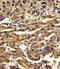 ATP Binding Cassette Subfamily G Member 1 antibody, A01227-1, Boster Biological Technology, Immunohistochemistry paraffin image 